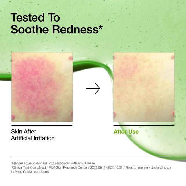 anua-azelaic-acid-10-hyaluron-redness-soothing-serum-azelainis-mzhavis-shrati-30ml-photo-3