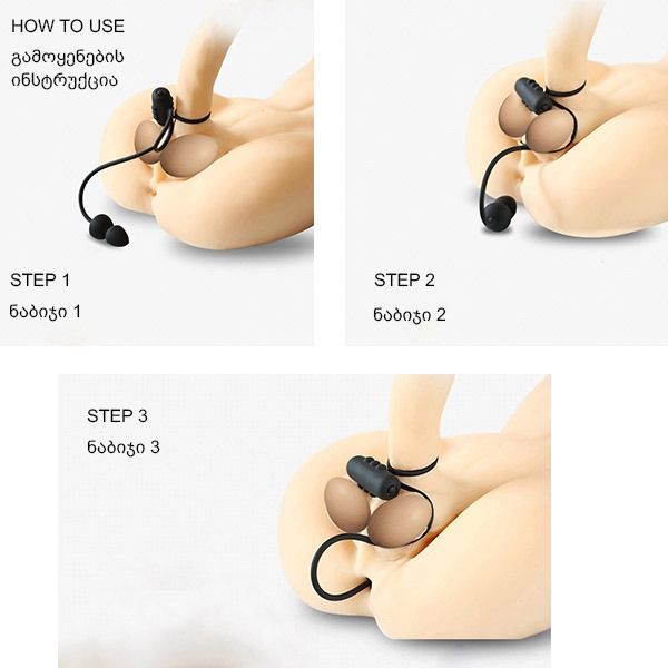 satsobiani-vibro-rgoli-photo-3