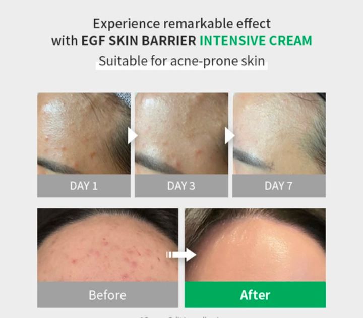 zipiderm-egf-skin-barrier-intensive-cream-sakhis-kremi-80-ml-photo-2