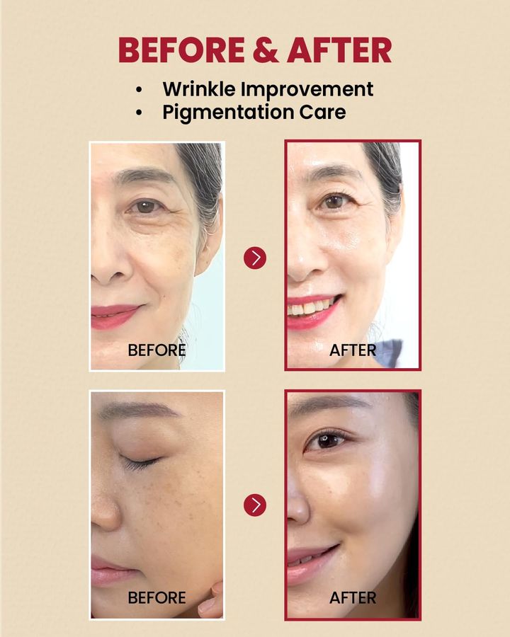 ksecret-seoul-1988-serum-retinal-liposome-2-black-ginseng-retinalis-shrati-photo-3