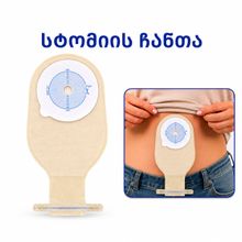 Product image of სტომას პარკი