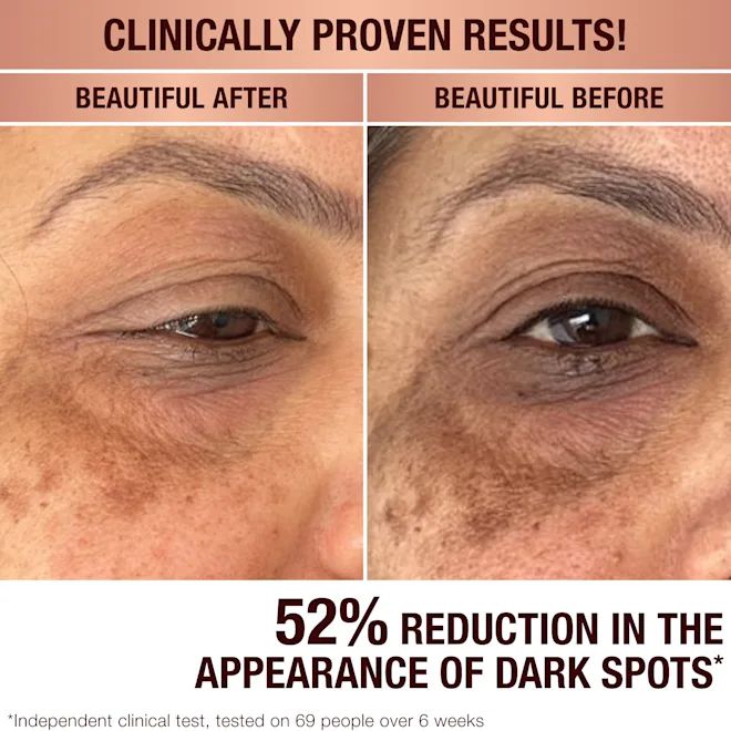 charlotte-tilbury-dark-spot-correcting-radiance-recovery-serum-tvalis-shrati-photo-2