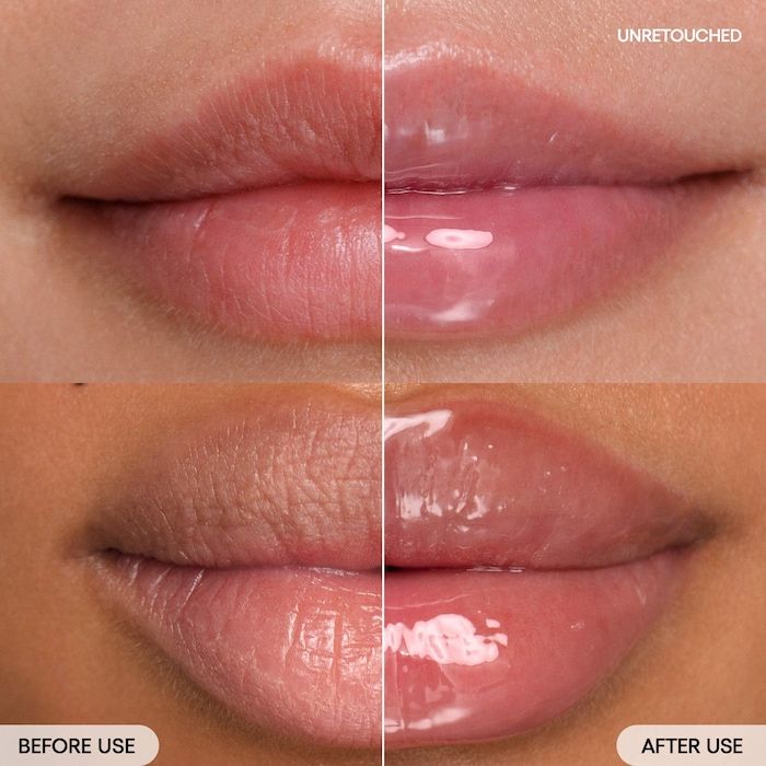 laneige-tuchis-balmi-photo-2