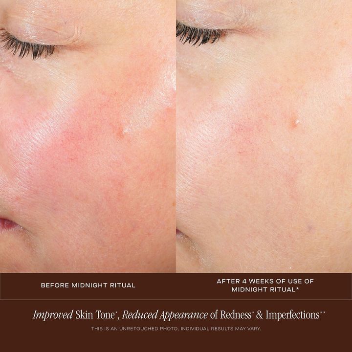 summer-fridays-midnight-ritual-retinol-renewal-serum-30ml-retinolis-serumi-photo-3