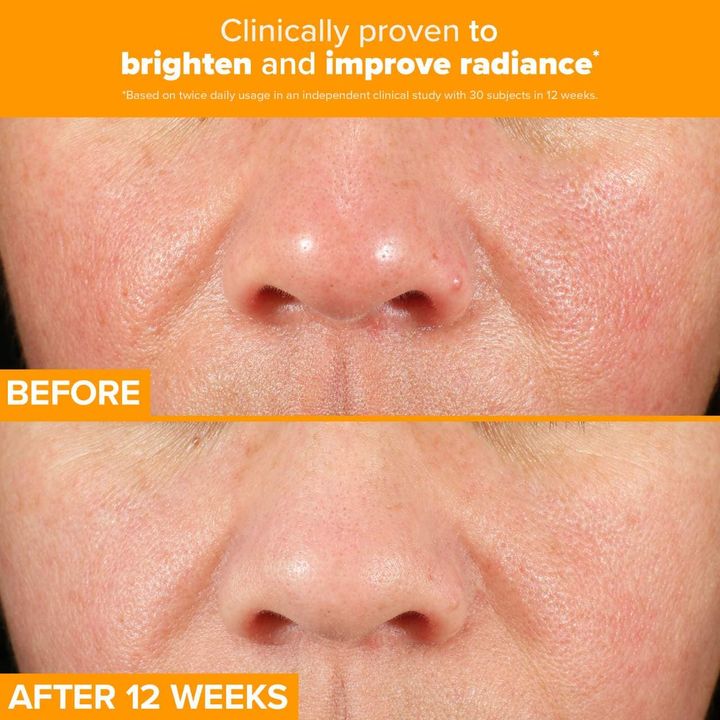 paulas-choice-c15-super-booster-for-brightening-dullness-uneven-tone-20ml-busteri-photo-3