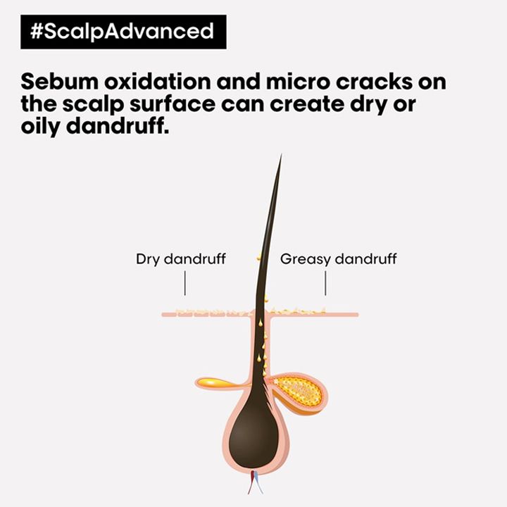 loreal-professionnels-scalp-advanced-shampuni-qertlis-satsinaaghmdego-300ml-photo-2