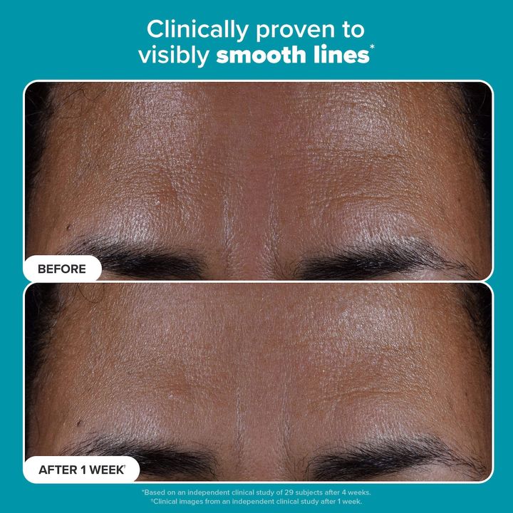 paulas-choice-2-bha-liquid-exfoliant---salitsilis-2-mzhavis-amqertslavi-toneri-photo-4