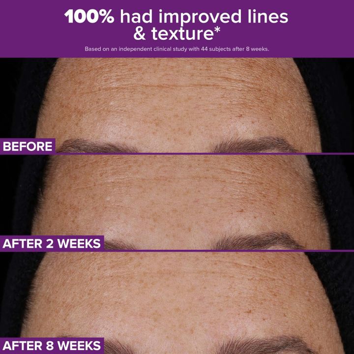 paulas-choice-clinical-pro-retinaldehyde-dual-retinoid-treatment-30ml-retinolis-shrati-photo-3