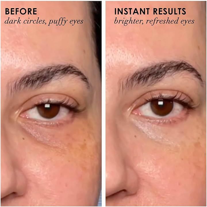 dermelect-revitalite-pro-eyelid-dark-circle-c-corrector-tvalis-kremi-photo-4