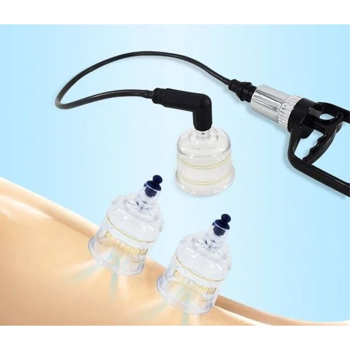 vakuum-qilebis-kompleqti-masazhistvis-photo-2