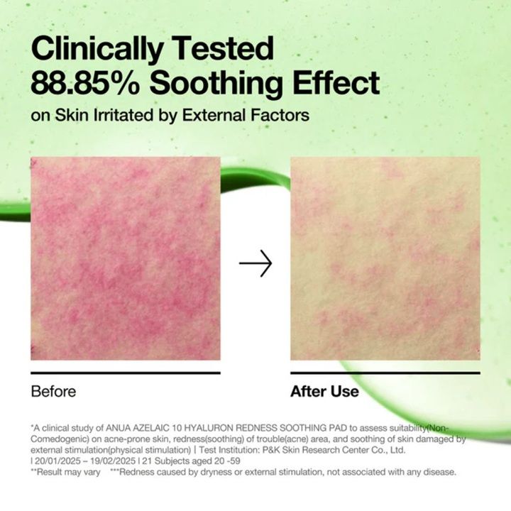 anua-azelaic-10-hyaluron-redness-soothing-pad-azelainis-da-hialuronis-damamshvidebeli-padebi-photo-3