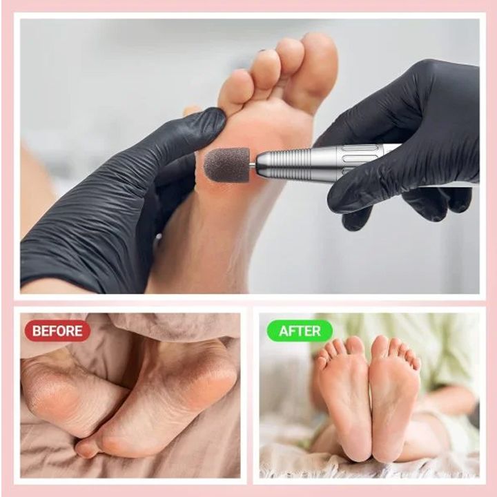 frezeris-tavebi-polirebistvis-photo-3