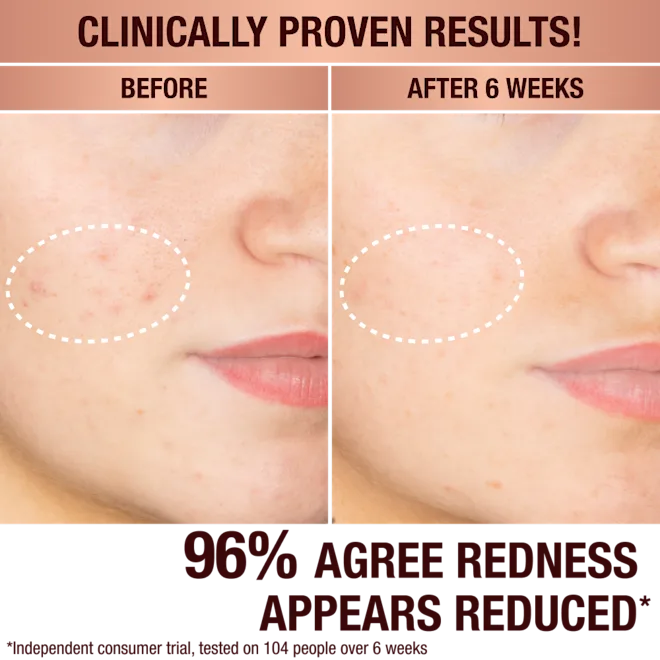 charlotte-tilbury-dark-spot-correcting-radiance-recovery-serum-tvalis-shrati-photo-3