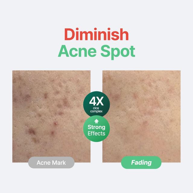 purito-seoul-wonder-releaf-centella-serum-unscented--tsentelas-shrati-photo-3