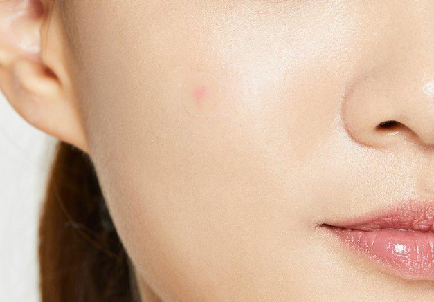 cosrx-acne-pimple-master-patch-24-patches-aknes-plastirebi-photo-4