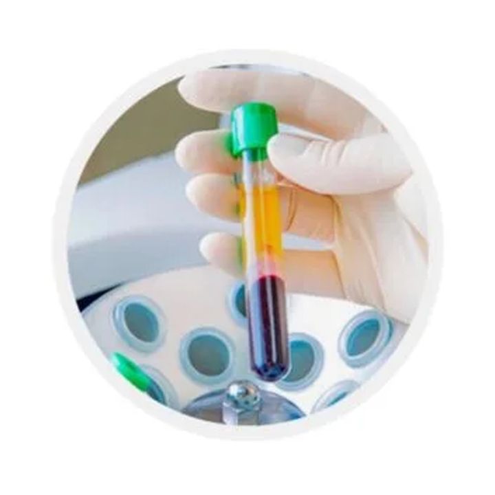dr-renat-akhmerov-premium-plazmoliftingis-sinjara-photo-3
